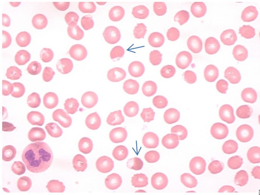 blood
