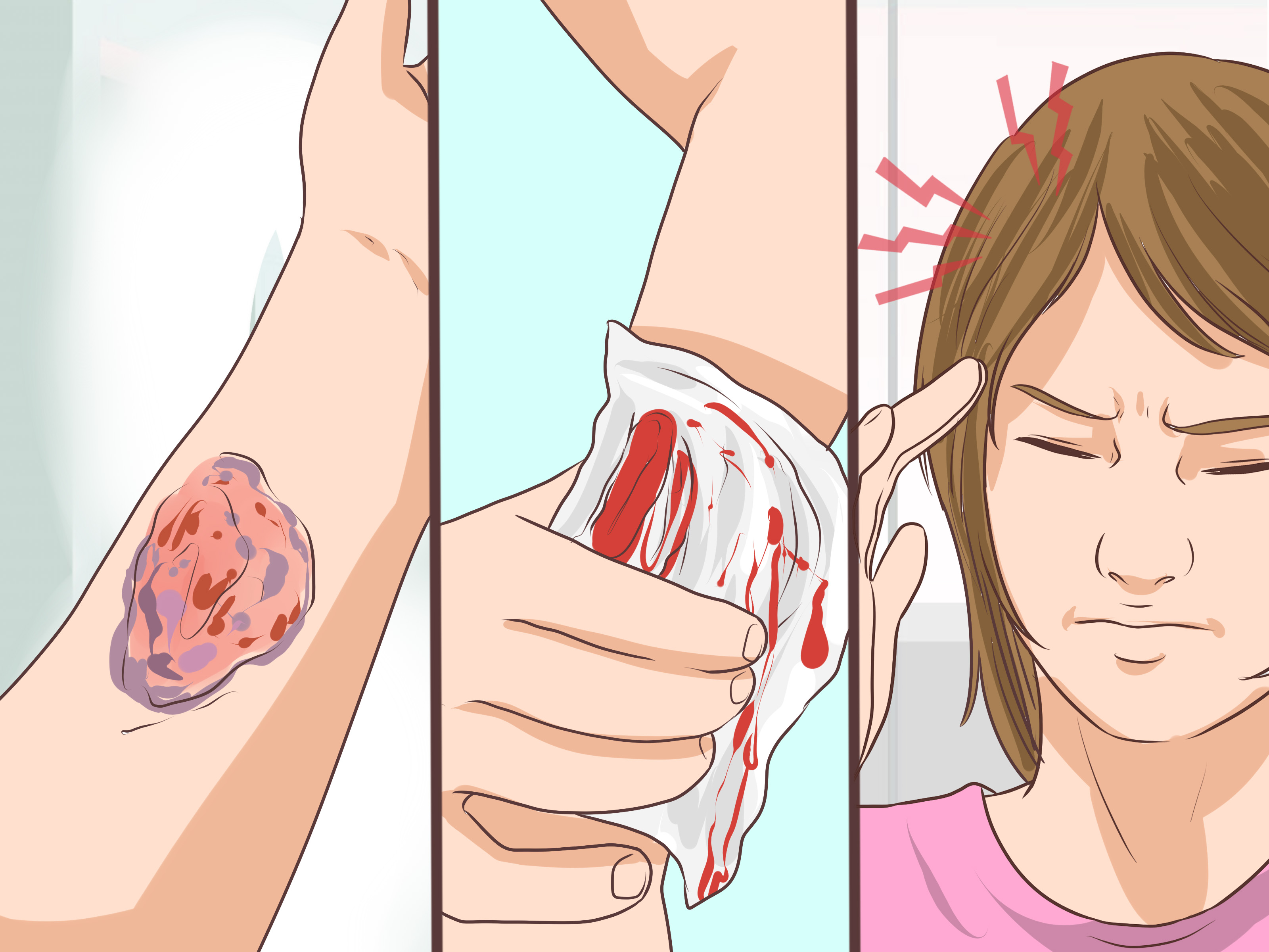 hemophilia