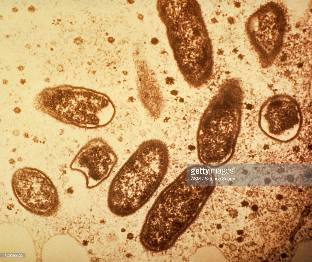 Rickettsia